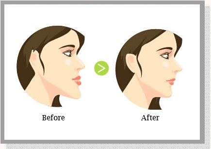改變臉型2